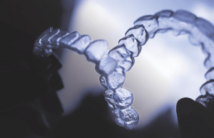 What new dental braces technology trends you should know about for your treatment option?